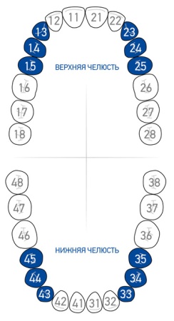 Кламп для коффердама Dentech (Япония) 1